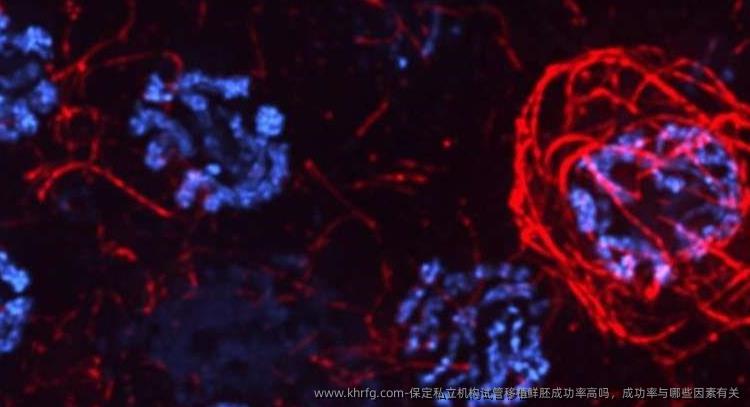 保定私立机构试管移植鲜胚成功率高吗,成功率与哪些因素有关
