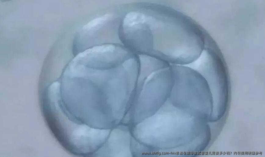 hiv患者在蚌埠做试管婴儿需要多少钱?内有费用明细参考