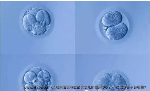 北京朝阳医院做试管婴儿的费用多少？一次试管会不会很贵？