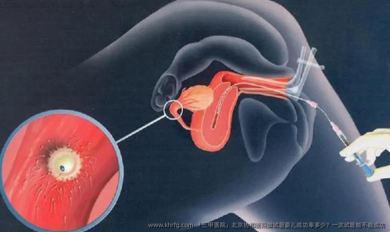 「三甲医院」北京协和医院做试管婴儿成功率多少？一次试管能不能成功