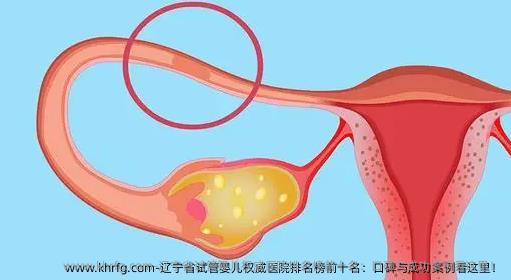 辽宁省试管婴儿优秀医院排名榜前十名：口碑与成功案例看这里！