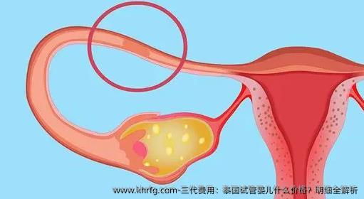 三代费用：泰国试管婴儿什么价格？明细全解析