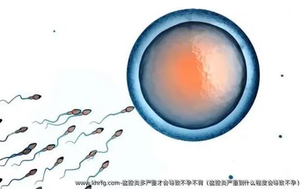 盆腔炎多严重才会导致不孕不育（盆腔炎严重到什么程度会导致不孕）