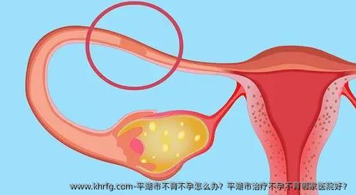 平湖市不育不孕怎么办？平湖市治疗不孕不育哪家医院好？