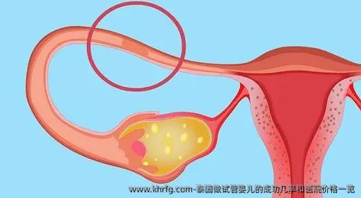 泰国做试管婴儿的成功几率和医院价格一览